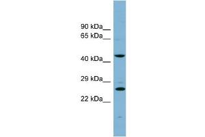 WB Suggested Anti-VPS28 Antibody Titration: 0. (VPS28 抗体  (N-Term))