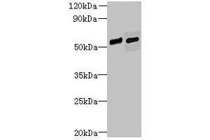 Western blot All lanes: FAM124B antibody at 12 μg/mL Lane 1: Hela whole cell lysate Lane 2: K562 whole cell lysate Secondary Goat polyclonal to rabbit IgG at 1/10000 dilution Predicted band size: 51, 32 kDa Observed band size: 51 kDa (FAM124B 抗体  (AA 146-272))
