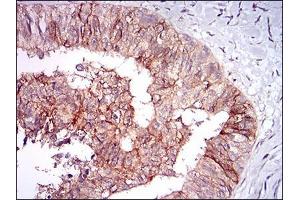 Immunohistochemistry (IHC) image for anti-tyrosine Kinase with Immunoglobulin-Like and EGF-Like Domains 1 (TIE1) (AA 385-607) antibody (ABIN2683015)