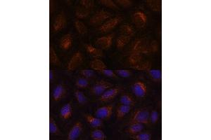 Immunofluorescence analysis of U-2 OS cells using  antibody (ABIN6131176, ABIN6136646, ABIN6136647 and ABIN6222857) at dilution of 1:100. (AGR2 抗体  (AA 21-175))