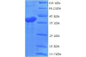SDS-PAGE (SDS) image for Abhydrolase Domain Containing 14B (ABHD14B) (AA 2-210) protein (His-SUMO Tag) (ABIN5711603)