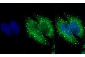 Detection of HADH in Human HepG2 cell using Polyclonal Antibody to Hydroxyacyl Coenzyme A Dehydrogenase (HADH) (HADH 抗体  (AA 1-236))