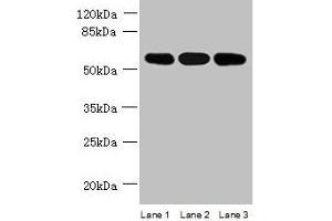 Western blot All lanes: STK33 antibody at 4 μg/mL Lane 1: Mouse kidney tissue Lane 2: Hela whole cell lysate Lane 3: Jurkat whole cell lysate Secondary Goat polyclonal to rabbit IgG at 1/10000 dilution Predicted band size: 58, 51 kDa Observed band size: 58 kDa