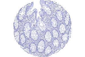 Complete absence of AR staining in normal colon mucosa (Recombinant Androgen Receptor 抗体  (AA 1-100))