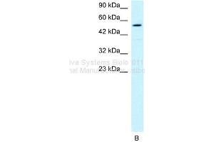 WB Suggested Anti-HLX1 Antibody Titration: 1ug/mlPositive Control: HepG2 cell lysate (HLX 抗体  (Middle Region))