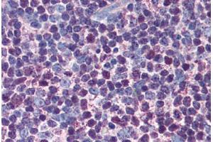 Human Thymus (formalin-fixed, paraffin-embedded) stained with CASP3 antibody ABIN305732 at 5 ug/ml followed by biotinylated anti-mouse IgG secondary antibody ABIN481714, alkaline phosphatase-streptavidin and chromogen. (Caspase 3 抗体)