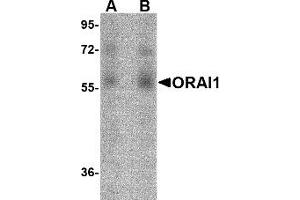 Western Blotting (WB) image for anti-ORAI Calcium Release-Activated Calcium Modulator 1 (ORAI1) antibody (ABIN1031711) (ORAI1 抗体)