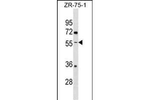 ENTPD5 Antibody (C-term) (ABIN1537153 and ABIN2838297) western blot analysis in ZR-75-1 cell line lysates (35 μg/lane). (ENTPD5 抗体  (C-Term))