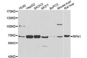 Western blot analysis of extracts of various cell lines, using RPN1 antibody. (RPN1 抗体  (AA 20-280))