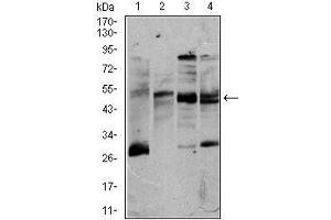 Western blot analysis using CD5 mouse mAb against K562 (1), Jurkat (2), Raji (3), and MOLT4 (4) cell lysate. (CD5 抗体  (AA 27-233))