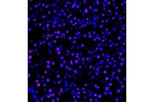 Immunofluorescence of paraffin embedded mouse pancreas using PP4R2 (ABIN7075284) at dilution of 1:1000 (400x lens) (PPP4R2 抗体)