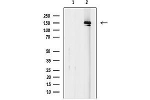 anti-Apoptotic Chromatin Condensation Inducer 1 (ACIN1) antibody