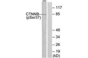 Western blot analysis of extracts from 293 cells, using Catenin-beta (Phospho-Ser37) Antibody. (beta Catenin 抗体  (pSer37))