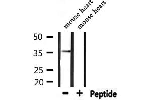 Western blot analysis of extracts from mouse heart, using TAS2R9 Antibody. (TAS2R9 抗体)