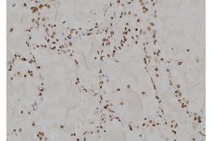 ABIN6275651 at 1/100 staining Human  tissue by IHC-P. (USP13 抗体  (C-Term))