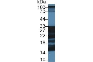 Western Blot; Sample: Porcine Cerebrum lysate; Primary Ab: 1µg/ml Rabbit Anti-Human SNAP25 Antibody Second Ab: 0. (SHISA4 抗体  (AA 28-197))