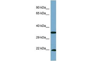 Host:  Rabbit  Target Name:  SLC6A6  Sample Type:  PANC1 Whole cell lysates  Antibody Dilution:  1. (TAUT 抗体  (C-Term))