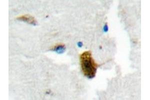 Immunohistochemistry analyzes of MgcRacGAP antibody in paraffin-embedded human brain tissue. (RACGAP1 抗体)