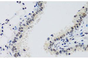 Immunohistochemistry of paraffin-embedded Mouse lung using CCNE2 Polyclonal Antibody at dilution of 1:100 (40x lens). (Cyclin E2 抗体)