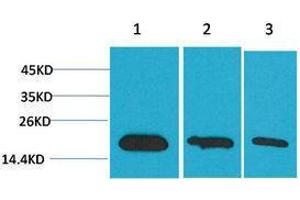 Western Blotting (WB) image for anti-Baculoviral IAP Repeat-Containing 5 (BIRC5) antibody (ABIN3181563) (Survivin 抗体)