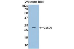 Western Blotting (WB) image for anti-Dual Specificity Phosphatase 3 (DUSP3) (AA 2-185) antibody (ABIN1077979) (Dual Specificity Phosphatase 3 (DUSP3) (AA 2-185) 抗体)