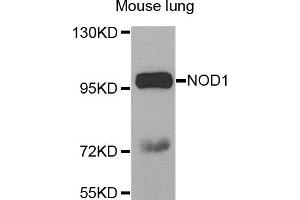 Western blot analysis of extracts of Mouse lung tissue, using NOD1 antibody. (NOD1 抗体)