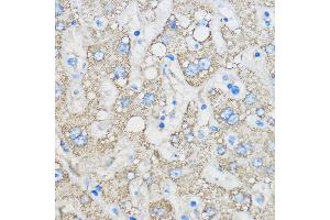 Immunohistochemistry of paraffin-embedded Human liver using R Rabbit pAb (ABIN6131585, ABIN6146704, ABIN6146705 and ABIN6222716) at dilution of 1:50 (40x lens).