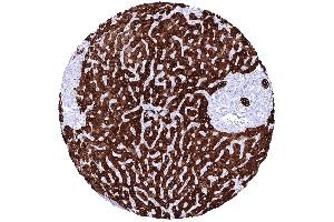 Liver In the liver a strong cytoplasmic staining of all bile ductal epithelial cells and an at least moderate predominantly membranous immunostaining of hepatocytes is seen (Recombinant pan Keratin 抗体)