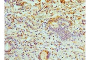 Immunohistochemistry of paraffin-embedded human kidney tissue using ABIN7175230 at dilution of 1:100