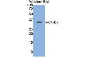Detection of Recombinant NB1, Mouse using Polyclonal Antibody to Neutrophil Specific Antigen 1 (NB1) (CD177 抗体  (AA 193-468))