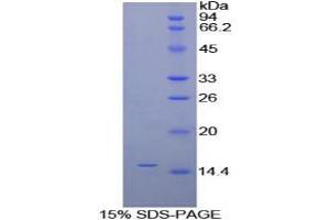 SDS-PAGE analysis of Human alpha Galactosidase Protein. (GLA 蛋白)