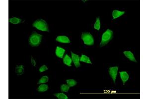 Immunofluorescence of monoclonal antibody to LZTFL1 on HeLa cell. (LZTFL1 抗体  (AA 200-299))