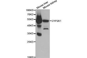 Western blot analysis of extracts of various cell lines, using CYP2E1 antibody. (CYP2E1 抗体  (AA 234-493))