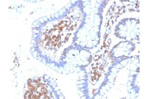 Formalin-fixed, paraffin-embedded human Colon stained with MAPK14 Mouse Monoclonal Antibody (CPTC-MAPK14-1). (MAPK14 抗体)