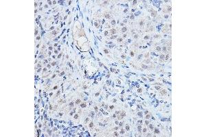 Immunohistochemistry of paraffin-embedded rat ovary using DGCR8 Rabbit pAb (ABIN7266761) at dilution of 1:200 (40x lens). (DGCR8 抗体)