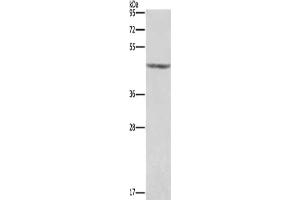 Gel: 8 % SDS-PAGE, Lysate: 40 μg, Lane: Human placenta tissue , Primary antibody: ABIN7191188(KCNJ9 Antibody) at dilution 1/350, Secondary antibody: Goat anti rabbit IgG at 1/8000 dilution, Exposure time: 1 second (KCNJ9 抗体)