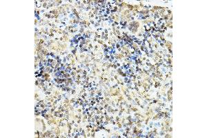 Immunohistochemistry (IHC) image for anti-Nuclear Receptor Subfamily 3, Group C, Member 1 (Glucocorticoid Receptor) (NR3C1) (AA 1-280) antibody (ABIN3023091)