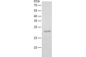 Western Blotting (WB) image for Fibroblast Growth Factor 19 (FGF19) (AA 23-216) protein (His tag) (ABIN7122928) (FGF19 Protein (AA 23-216) (His tag))