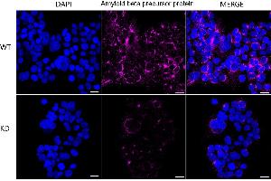 Immunocytochemical staining of HeLa cells using Amyloid beta precursor protein antibody (ABIN7797593), 1:1,000), Top panel: wild-type (WT), Bottom panal: Amyloid beta precursor protein shRNA knockdown (KD). (Recombinant APP 抗体)