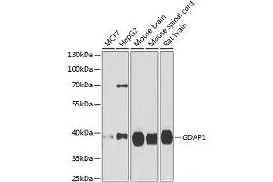 Western blot analysis of extracts of various cell lines using GDAP1 Polyclonal Antibody at dilution of 1:1000. (GDAP1 抗体)