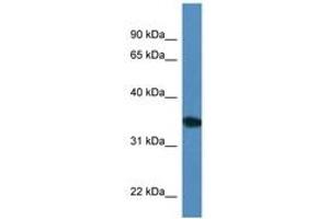 Image no. 1 for anti-Uridine Phosphorylase 2 (UPP2) (AA 200-249) antibody (ABIN6746297) (UPP2 抗体  (AA 200-249))