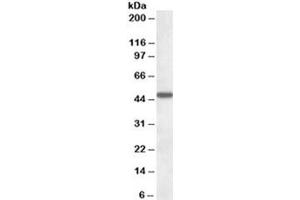 Western blot testing of human liver lysate with AADAT antibody at 1ug/ml. (AADAT 抗体)