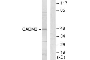 Western blot analysis of extracts from HepG2 cells, using CADM2 antibody. (CADM2 抗体)