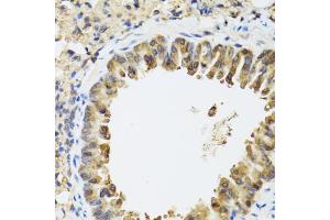 Immunohistochemistry of paraffin-embedded mouse lung using STAT3 antibody (ABIN1876697) at dilution of 1:100 (40x lens). (STAT3 抗体)