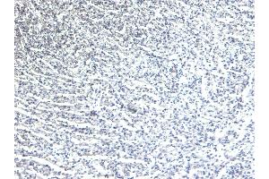 (ABIN185584) Negative Control showing staining of paraffin embedded Human Heart, with no primary antibody. (ADRB1 抗体  (Internal Region))