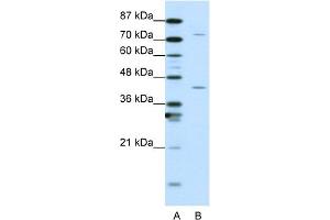 WB Suggested Anti-TCEA1 Antibody Titration:  1. (TCEA1 抗体  (N-Term))