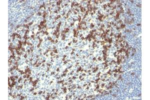 Formalin-fixed, paraffin-embedded human Tonsil stained with PD1 (CD279) Monoclonal Antibody (PDCD1/922). (PD-1 抗体)