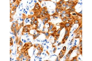 Immunohistochemistry (IHC) image for anti-Solute Carrier Family 2 (Facilitated Glucose Transporter), Member 11 (SLC2A11) antibody (ABIN2426005) (SLC2A11 抗体)