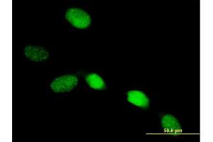 Immunofluorescence of purified MaxPab antibody to SOX13 on HeLa cell. (SOX13 抗体  (AA 1-622))