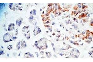 Human pancreas tissue was stained by Rabbit Anti-AdrenomeduIIiln-Gly (Human) Antibody (Adrenomedullin-Gly 抗体)